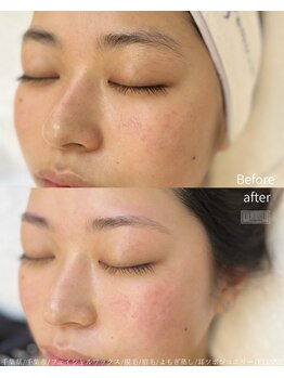 エリス(ELISSE)/自分に合った眉になる