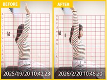 整体院 元 光の森店/肩の痛みと姿勢の悪さの悩み