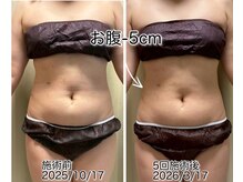 クールスパ(COOL SPA)/【100カップ途中経過】