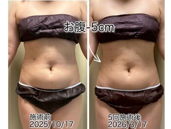 クールスパ(COOL SPA)/【100カップ途中経過】