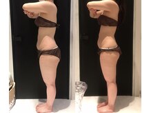 リボディ 表参道(An re Body)/before→after