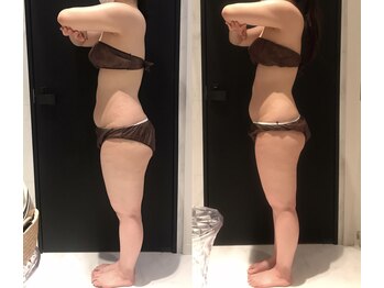 リボディ 表参道(An re Body)/before→after