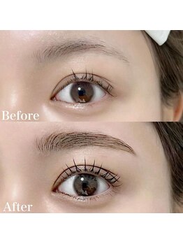 レピア 高槻店/韓国式LEPIA Before&After