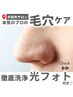 【お鼻の毛穴集中ケア】光フォト付き毛穴洗浄FACIAL（30分）