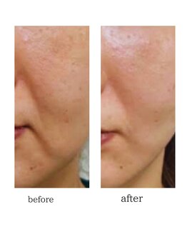 サロン リノ(salon rino)/