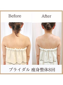 サロンルーチェ(Salon Luce)/ビフォーアフター/ブライダル