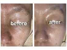 マイルーム(my room)/【before/after】