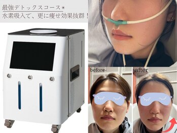 ヨサパーク 温美(YOSA PARK)の写真/マンツーマン施術でお悩みに徹底アタック。よもぎ×水素を使用したワンランク上の極上デトックス痩身を体験