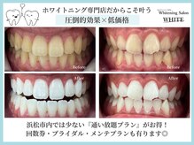 ホワイト(WHITE)/圧倒的効果と満足度★