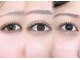 アマンズアイ(amans eye)の写真
