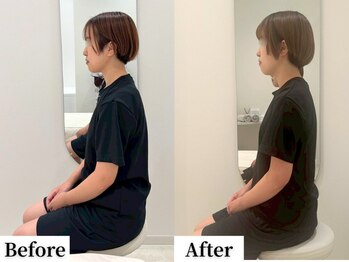 ソレア(Solea)/肩こり改善1回目