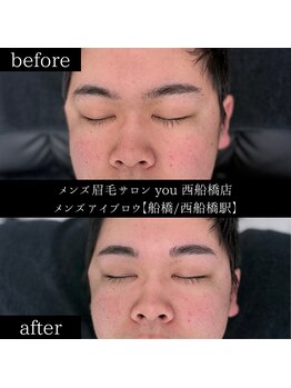 ユー 西船橋店(you)/ビフォーアフターお写真