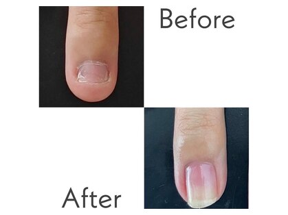 ネイルクリニーク 福岡店(NAIL CLINIQUE)の写真