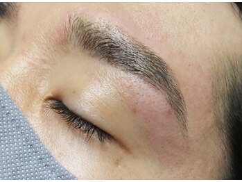 アンジェリーナ/メンズ眉脱毛/脱毛後
