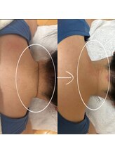 高槻 インサイド(Inside)/ビフォー・アフター