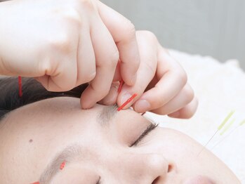 ラピス 玉造(Lapis)/小顔美容鍼