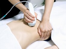 マリア(MARIA)/WINBACK施術