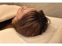 デルタエヌピー63+(δnp63+)/施術[薬院/小顔鍼/ヘッドスパ]