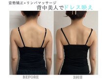 プルチャームエクイデム(Pulchram equidem)/猫背、巻き肩、肩甲骨矯正+機械