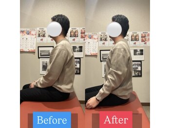 ナオル整体 宮崎院(NAORU整体)/20代男性施術事例【猫背改善】