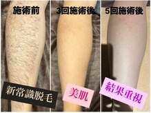 ワンエイト(One Eight)