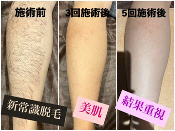 ワンエイト(One Eight)