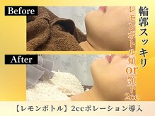 ポーベルポー(Peau Belle poe)