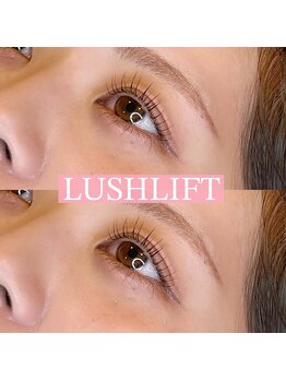 リンド エステ まつげ 京成大久保(Lind)/ラッシュリフト