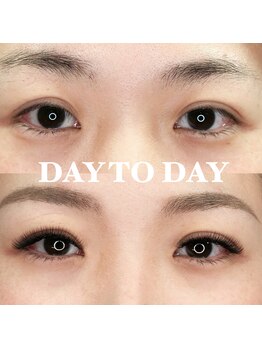 デイトゥデイ(DAY TO DAY)/本数、デザインで見栄え自由自在