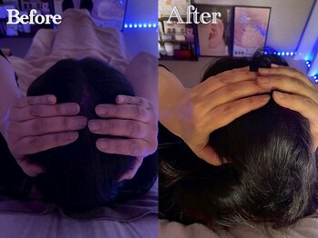 アールピーシャインズ(RP Shines)/骨格調整Before after