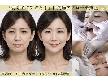 サロンチオリ 烏丸(Salon Chiori)/ダウンタイム無し!即メイクOK!