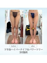 エスプレッソ(espresso,)/【全身痩身3回】足の隙間GET☆