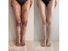 シンシアリー 広瀬通店(Sincerely)の雰囲気（つらい術後のダウンタイムにも◎）