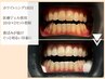 【効果実感】プレミアムセルフホワイトニング《20分×2回照射》 単発