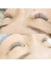 マニプーラ(Manipura)/