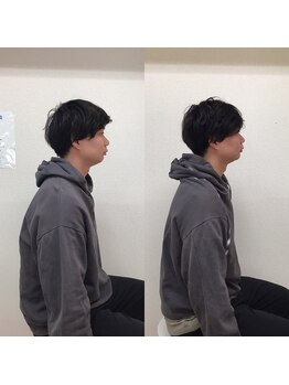 オズ六本木/六本木小顔矯正(造顔)姿勢整う