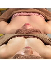 コモド(COMODO)/before&after