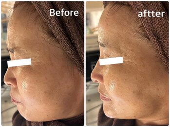 グラサヴォーグ 金沢店/引き締め♪小顔効果◎