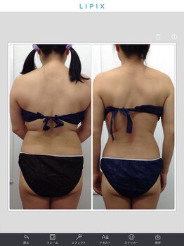 健康痩身研究所 蟹江店/ビフォーアフター