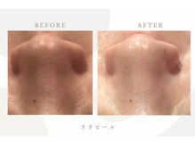 レヴ 都城店(rev)の雰囲気（お客様のお悩みを解決いたします！続けていくことが大事！）