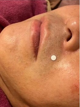 レイール(Reir)の写真/【人気のメンズ脱毛】脱毛で毛もお手入れの負担もなくしましょう☆今月限定プチエステ付き￥6,800　　