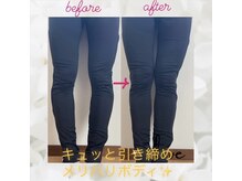 ヨサパーク エトワール 聖蹟桜ヶ丘店(YOSAPARK)/before、after♪