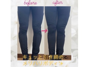 ヨサパーク エトワール 聖蹟桜ヶ丘店(YOSAPARK)/before、after♪