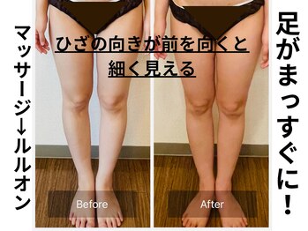 ヨサパーク ルアナ 高島店(YOSA PARK Luana)/O脚もまっすぐに！