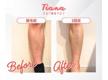 ティアナ 鶴見店(Tiana)/before→after