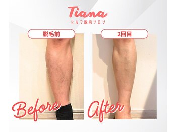 ティアナ 鶴見店(Tiana)/before→after
