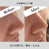 エムビューティーサロン(M Beauty Salon)
