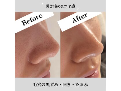 エムビューティーサロン(M Beauty Salon)の写真