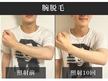 エルモリア(ELMOREA)の雰囲気（【年間2000人担当】丁寧なカウンセリングで初めての方も安心◎）