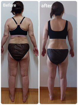 シャルマン(charmant)/キャビ、ラジオ波